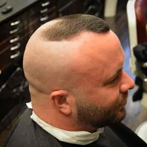 HIGH AND TIGHT FOR MEN WITH PARTIAL HAIR LOSS