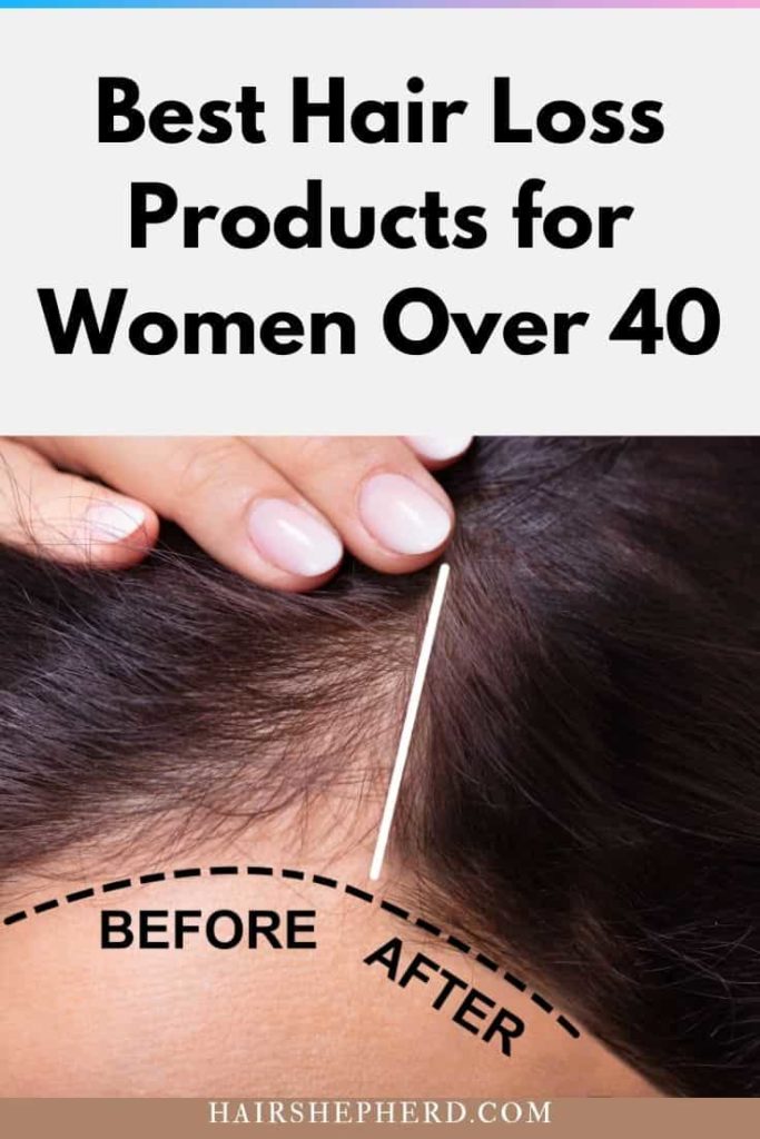 Hair Loss Products for Women Over 40