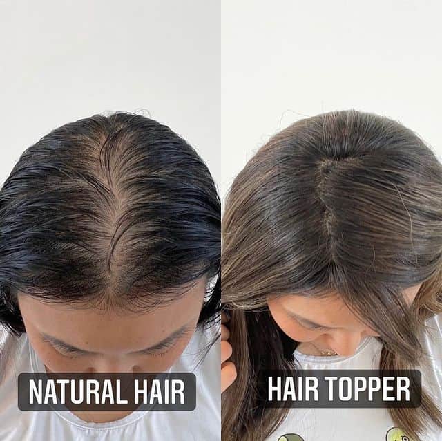 Hair Toppers for Thinning Hair Before and After