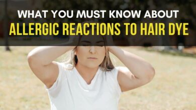 allergic reaction to hair dye, what you must know