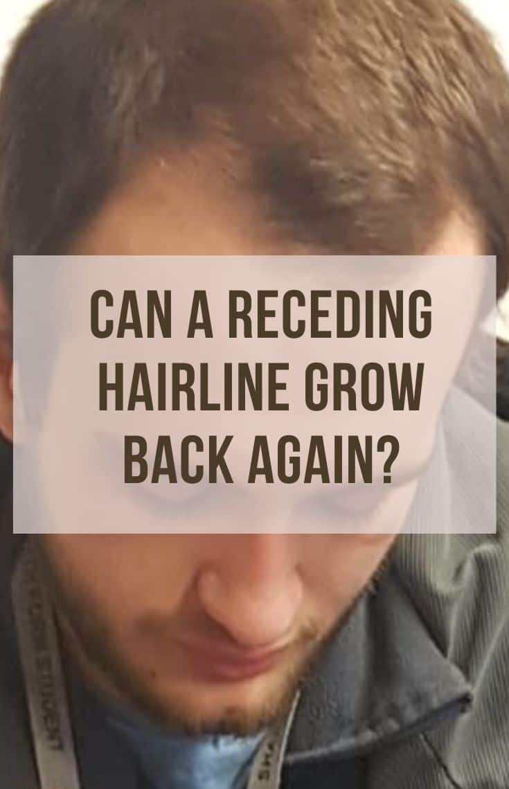 can a receding hairline grow back again
